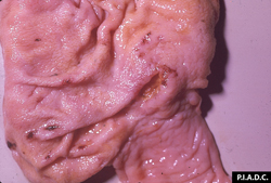 Malignant Catarrhal Fever: Bovine, cecum and ileum. There are scattered small foci of mucosal hemorrhage and erosion. 