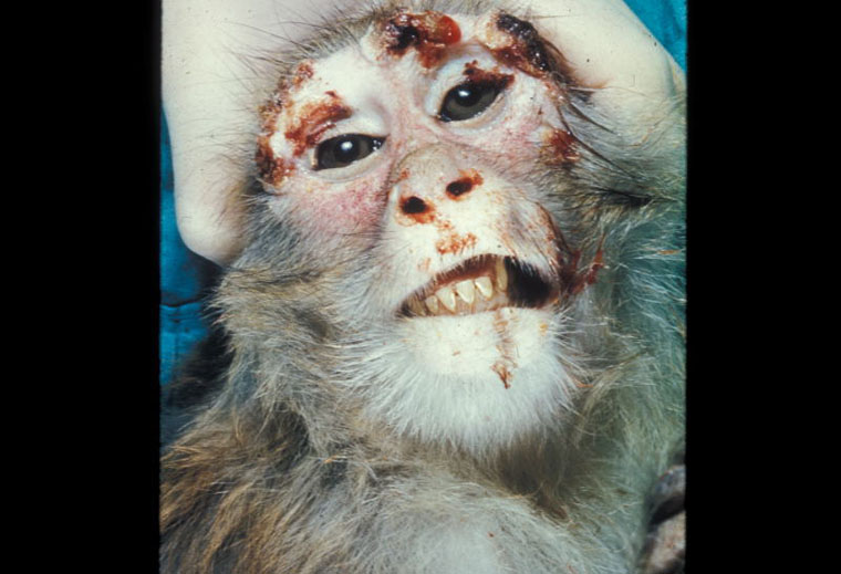 monkeypox: Rhesus macaque, skin. There are multiple hemorrhagic papules on the forehead and eyelids.