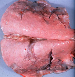 Adenomatosis Pulmonar Ovina: Ovino, pulmón. Los pulmones están sin colapsar y los bordes ventrales del pulmón contienen múltiples nódulos blancos proliferativos  y fibrosos. 