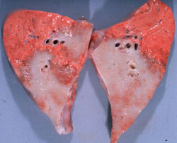 Adenomatosis Pulmonar Ovina: Ovino, pulmón. La superficie de corte del pulmón tiene masas proliferativas y fibrosas coalescentes claramente demarcadas de consistencia firme con coloración gris. 