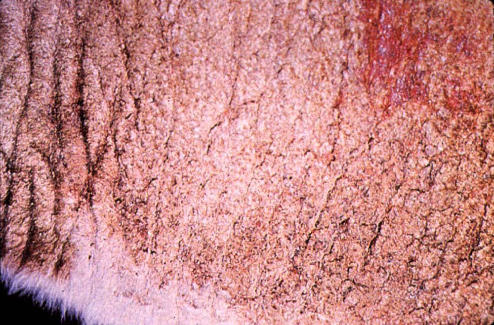 sheep-scab: Ovino, piel. Piel engrosada y perdida de vellón debido a la presencia del ácaro.