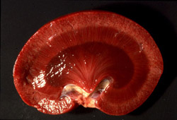 Rabbit Hemorrhagic Disease: Rabbit, kidney. There are petechiae throughout the cortex and the medulla is severely congested. 