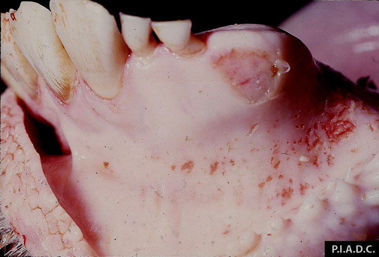rinderpest: Bovine, oral mucosa. There are numerous small gingival erosions.
