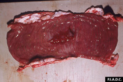 Peste Bovina: Bovino, íleon. La mucosa esta hemorrágica y edematosa, y las placas de Peyer deprimidas(necrosis).