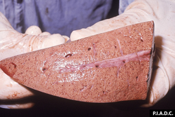 Fiebre del Valle del Rift: Ovino, hígado. La superficie de corte del hígado tumefacto, esta pálida y contiene muchas petequias.