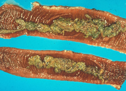 <i>Salmonella</i> (Nontyphoidal): Bovine, small intestine. The mucosa is reddened and covered by large yellow-brown casts of fibronecrotic exudate. 