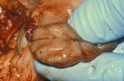 Salmonelosis: Cerdo, nódulo linfático mesentérico. El nódulo linfático esta inflamado y edematoso. Este nódulo es bueno para obtener cultivos.