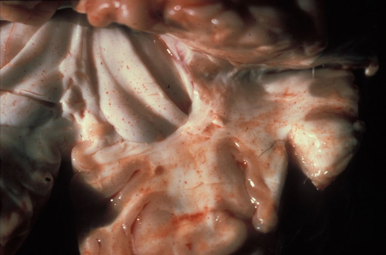 sarcocystosis: Bovino, cerebro. Cerebro con petequias multifocales difusas que son más prominentes en la materia blanca.