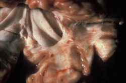 Sarcocistosis: Bovino, cerebro. Cerebro con petequias multifocales difusas que son más prominentes en la materia blanca.