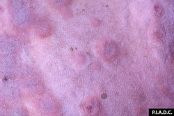 Viruela Ovina y Caprina: Caprino, piel. Pústulas rojas coalescentes con áreas centrales, ligeramente hundidas y pálidas (necróticas).  