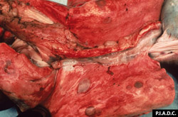 Sheep and Goat Pox: Small ruminant, lungs. The lungs contain multiple discrete tan to red-brown nodules (multifocal interstitial pneumonia). Mediastinal lymph nodes are enlarged.