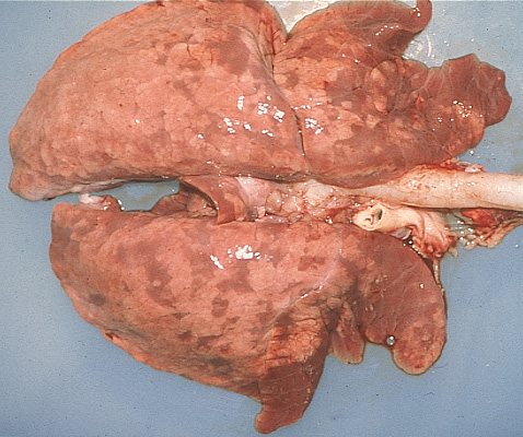 influenza: Suino, pulmón. Hay una consolidación difusa marrón clara de los lóbulos craneales; y una consolidación multifocal de los lóbulos caudales, compatible con neumonía broncointersticial.