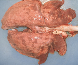 Influenza: Suino, pulmón. Hay una consolidación difusa marrón clara de los lóbulos craneales; y una consolidación multifocal de los lóbulos caudales, compatible con neumonía broncointersticial.