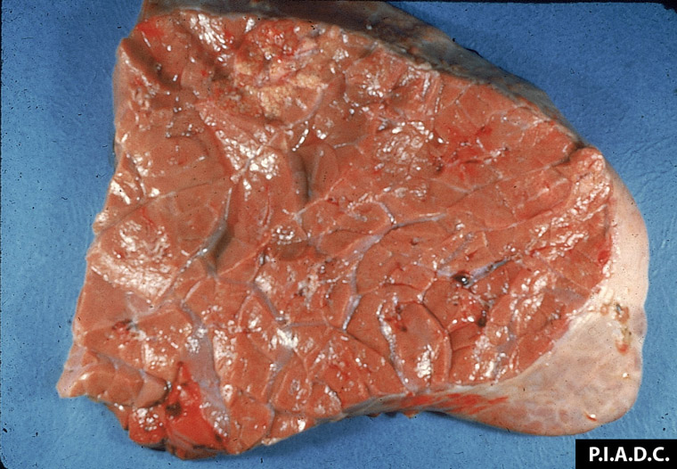 theileriosis: Bovino, pulmón. El tejido pulmonar tiene una coloración marrón-claro a marrón-oscuro. Los lóbulos no están colapsados y tienen una consistencia elástica (neumonía intersticial)