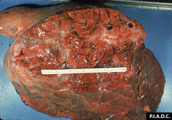 Theileriosis: Bovine, lung. The lobules are noncollapsed (rubbery) and diffusely tan-brown, and interlobular septa are markedly expanded due to edema and emphysema.