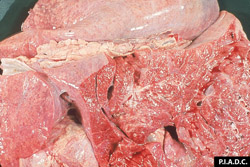 Theileriosis: Bovine, lungs. Lungs are diffusely noncollapsed, and there is moderate interlobular edema (interstitial pneumonia).