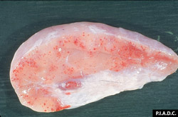 Teileriosis: Bovino, ganglio linfático poplíteo. El ganglio esta agrandado y difusamente pálido, y contiene numerosas petequias.  