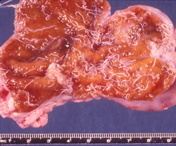 Trichuriasis: Perro, ciego. La mucosa está engrosada, hiperémica y cubierta por Trichuris vulpis adultos; la porción caudal más gruesa del nematodo, es lo que más se observa.