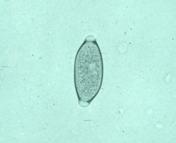 Trichuriasis: Humano, heces. Los huevos de los gusanos látigos son ovalados, membrana doble y prominencias transparentes en cada extremo.