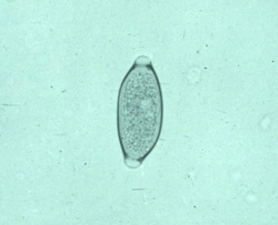 Trichuriasis: Human, feces. Whipworm eggs are oval, thick-shelled, and have transparent plugs at each pole.