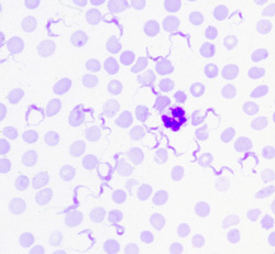 Trypanosomiasis (African): Rodent, blood smear. Numerous flagellated trypanosomes can be seen among erythrocytes and a neutrophil.