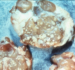 Tuberculosis Bovina: Cerdo, nódulo linfático. Granulomas pálidos y mineralizados están diseminados a lo largo de estos nódulos linfáticos.  