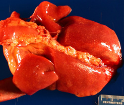 Tularemia: Felino, pulmón. Numerosos focos pálidos de menos de 1mm de diámetro están diseminados en todos los lóbulos pulmonares. 