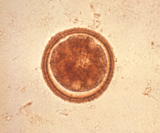 toxocariasis: Dog, feces. This unembryonated Toxocara canis egg has a thick, yellow-brown shell with a finely stippled surface. 