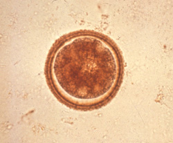 Toxocariasis: Dog, feces. This unembryonated Toxocara canis egg has a thick, yellow-brown shell with a finely stippled surface. 